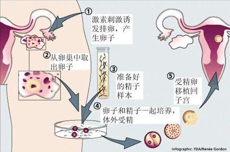 妇科专家